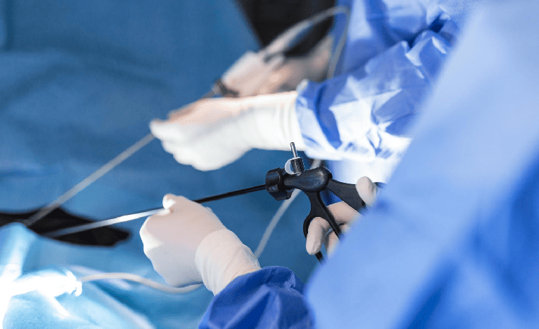 Procedimiento de Artroscopia de hombro en Cuernavaca e Iguala para Traumatología Y Ortopedia