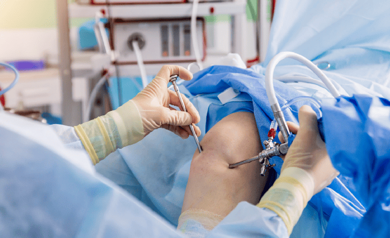 Procedimiento de Artroscopia de rodilla en Cuernavaca e Iguala en Traumatología Y Ortopedia